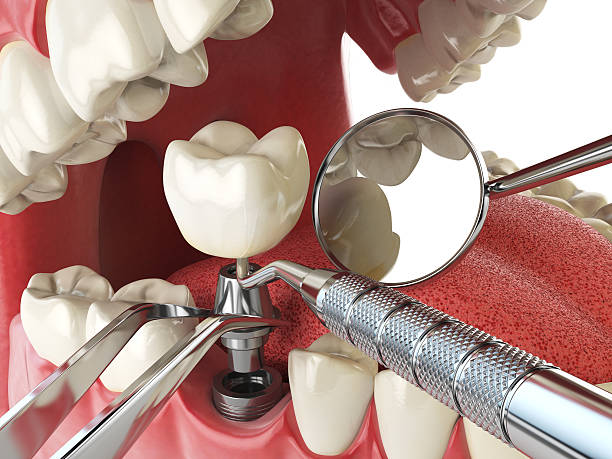 Best Emergency Dentist for Special Needs Patients in Water Valley, MS